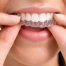 Digital Orthodontics