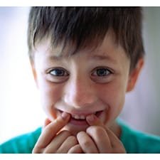 Kids Dental Care