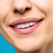 Laser Teeth Whitening