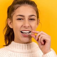 Invisible Braces / Clear Aligners