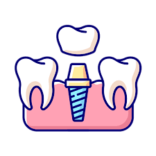 Dental Implants & Full Mouth Rehabilitation in Kota