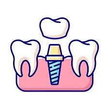 Dental Implants & Full Mouth Rehabilitation in Kota
