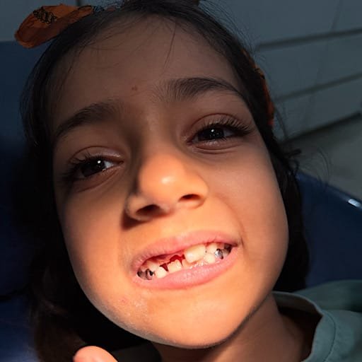 Kids Dentist in Kota