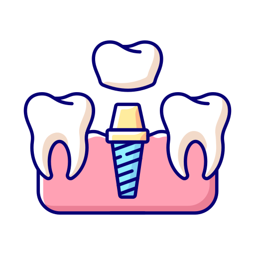 Dental Implants & Full Mouth Rehabilitation in Kota