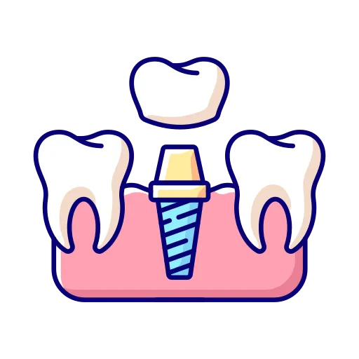 Dental Implants & Full Mouth Rehabilitation in Kota