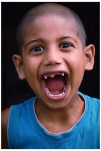 Kids Dentist in Kota