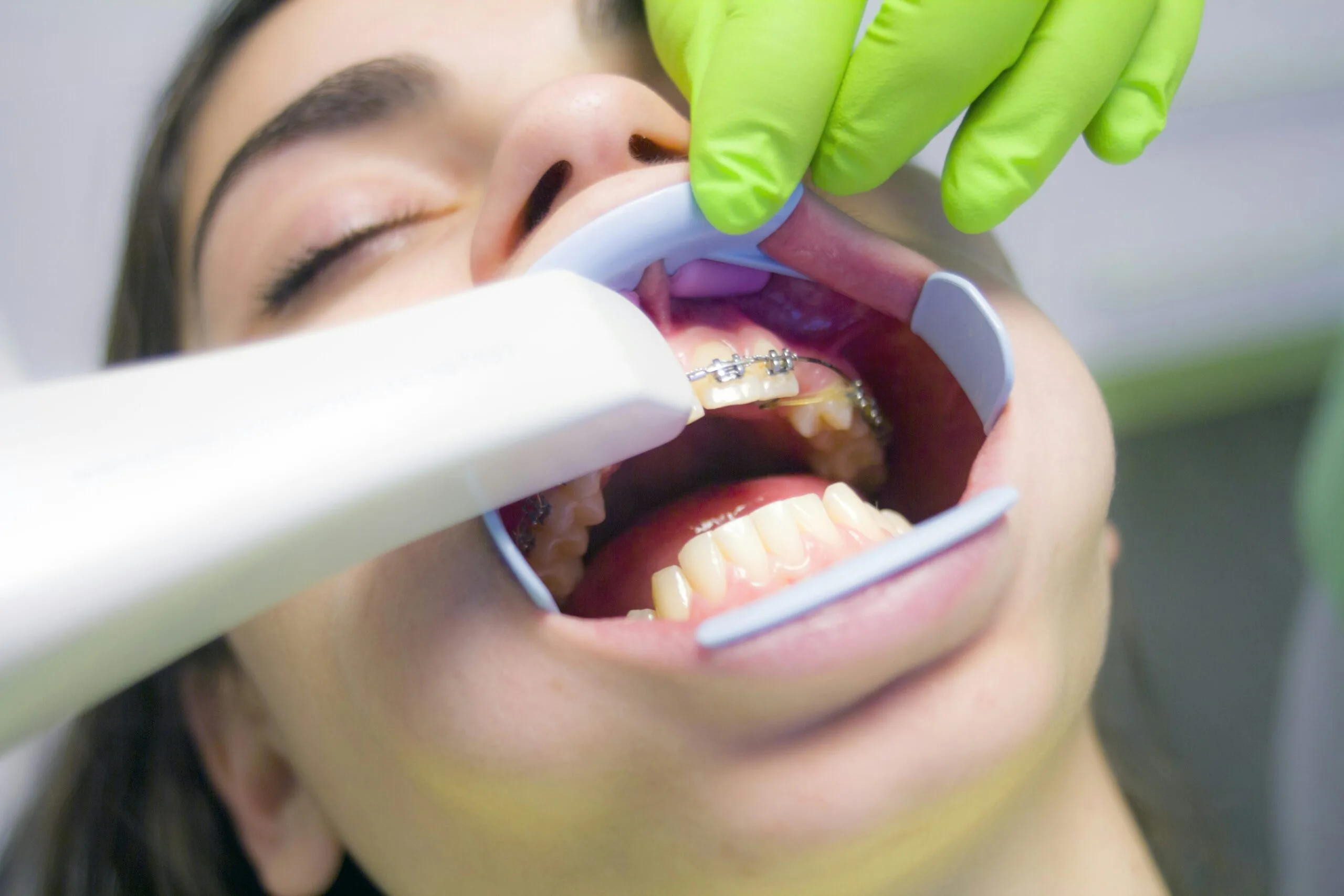 Digital Orthodontics